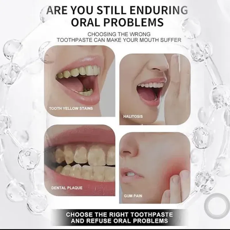 7.5% Nano Hydroxyapatite Teeth Whitening Toothpaste 120GM - Image 5